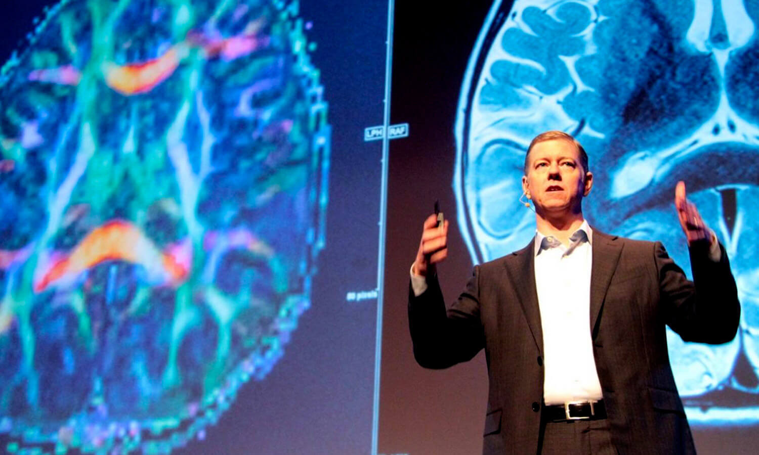 A speaker in a suit gestures on stage at the Cusp conference, accompanied by large, colorful brain scan images. The scene conveys a sense of scientific presentation and focus.